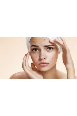  Акне. Здоровая кожа. Елена Корнилова