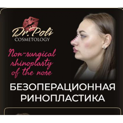 Безоперационная ринопластика. Полина Еремина dr.poli