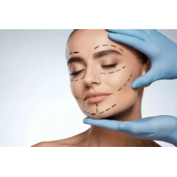 Ботулинотерапия Full-Face. Елена Разумовская Akkord