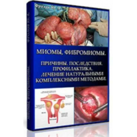 Миомы, Фибромиомы. Причины, мини инфопродукт №7 Юрий Фролов