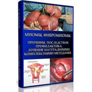 Миомы, Фибромиомы. Причины, мини инфопродукт №7 Юрий Фролов Миомы, Фибромиомы. Причины, мини инфопродукт №7 Юрий Фролов