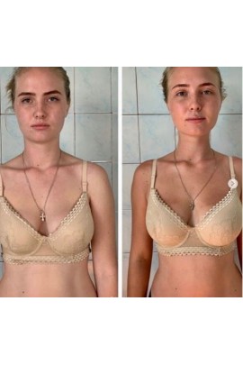 Восстановление молодости лица. 2.0. Вера Красивая