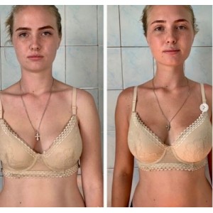 Восстановление молодости лица. 2.0. Вера Красивая Восстановление молодости лица. 2.0. Вера Красивая