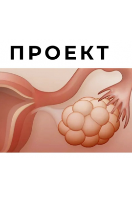 СПКЯ и другие нарушения менструального цикла. Гала Гарбузова