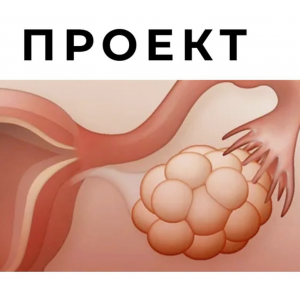 СПКЯ и другие нарушения менструального цикла. Гала Гарбузова