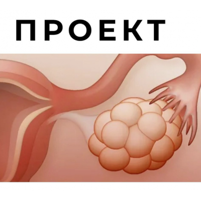 СПКЯ и другие нарушения менструального цикла. Гала Гарбузова