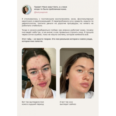 Проблемная кожа. katyaspivak