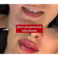 Контурная пластика губ длинной иглой. Расита Хапачева
