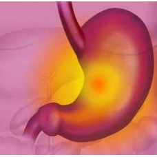 Коррекция желудка. Юджиния Квант