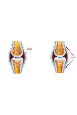 Здоровье суставов ног от А до Я. Тариф Минимум. Александра Бонина