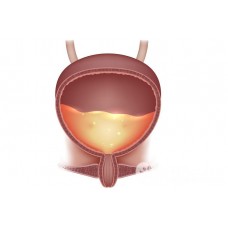 Коррекция мочевого пузыря. Юджиния Квант