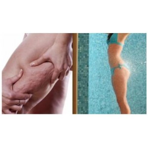 Французский антицеллюлитный массаж. Ольга Шарко