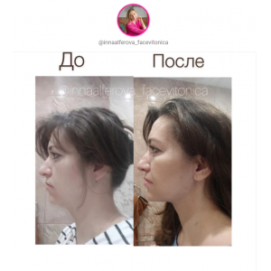 Глобальный курс: Лицо. Осанка. Таз. Инна Алферова